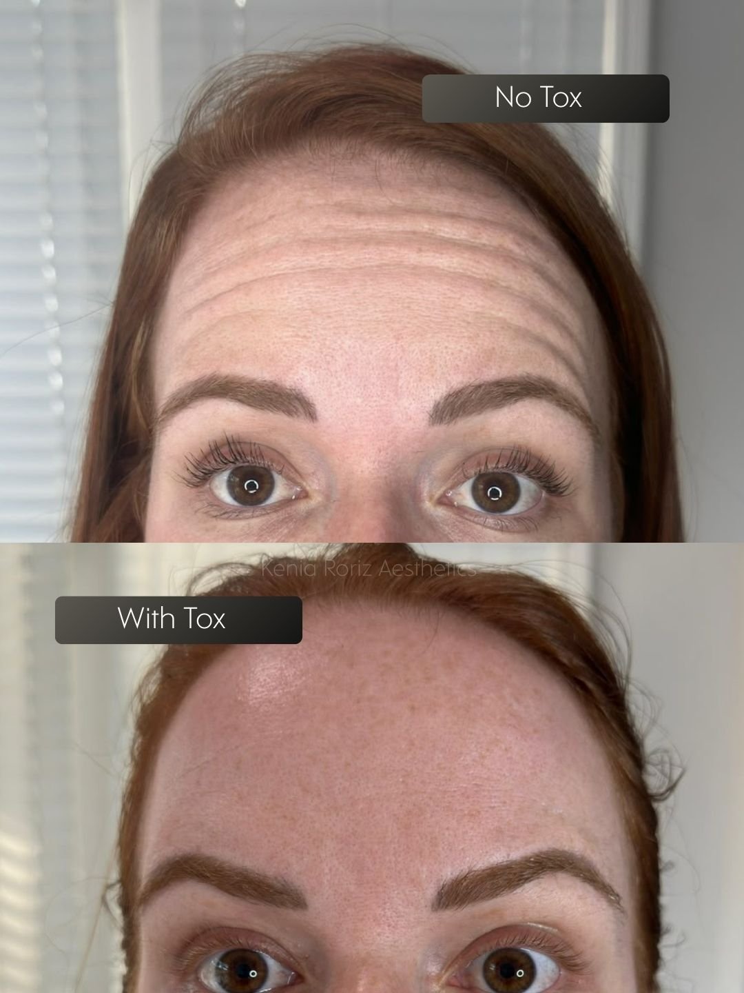 Tox before and after