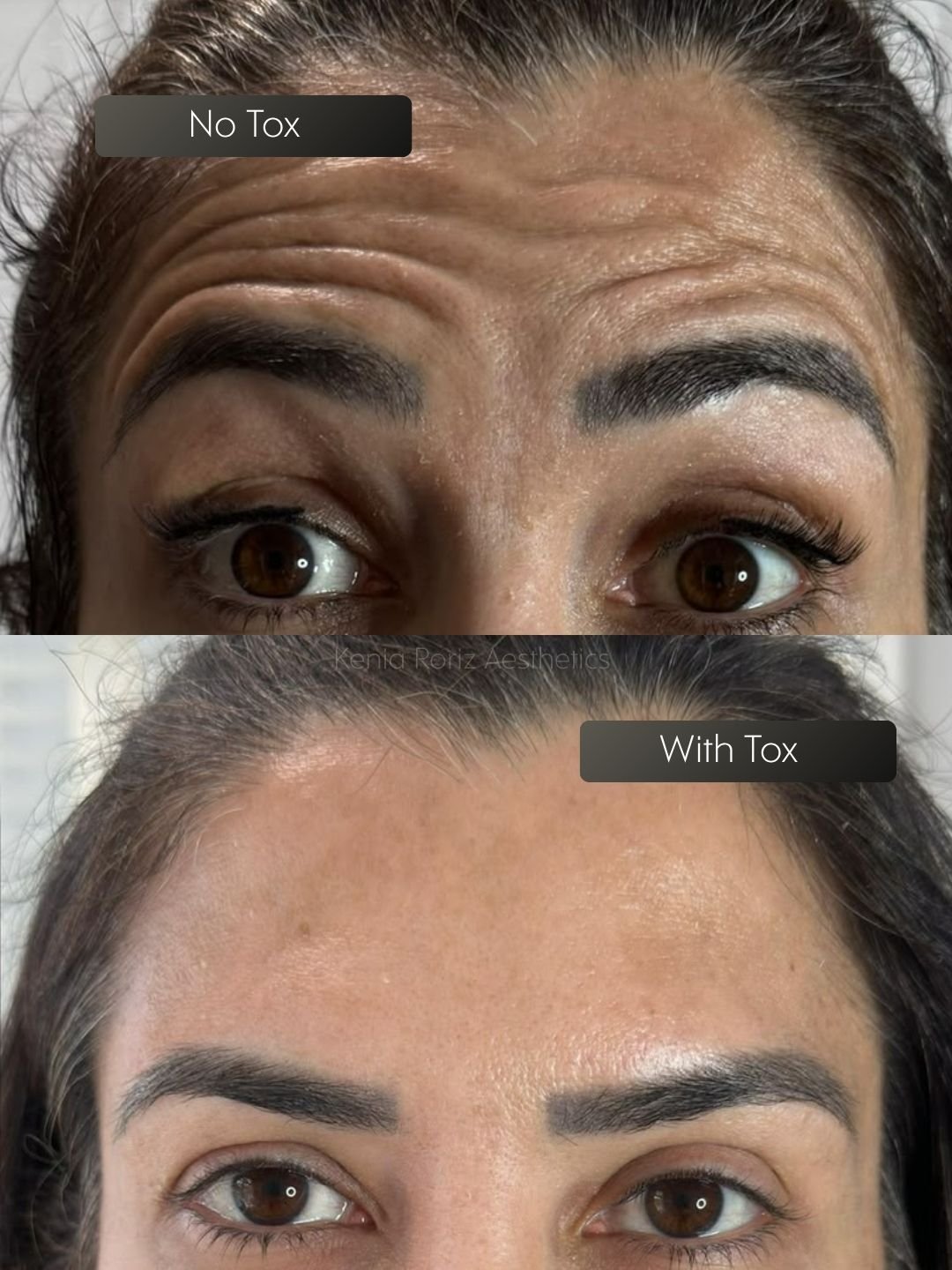 Tox before and after