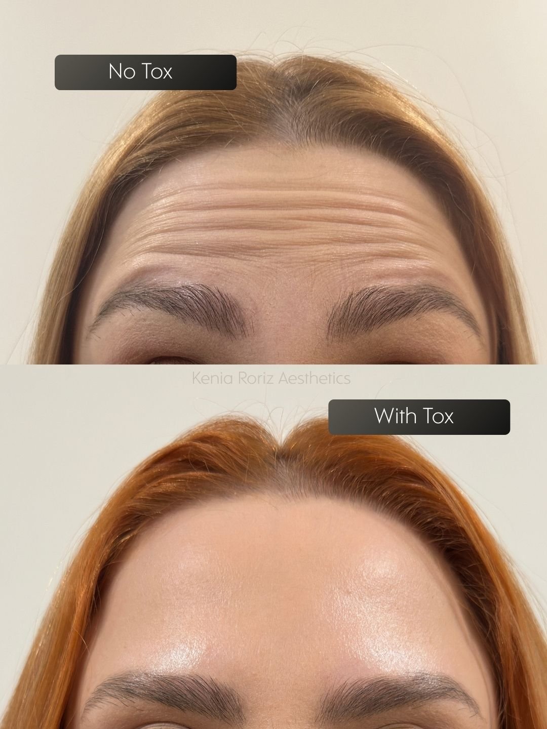 Tox before and after