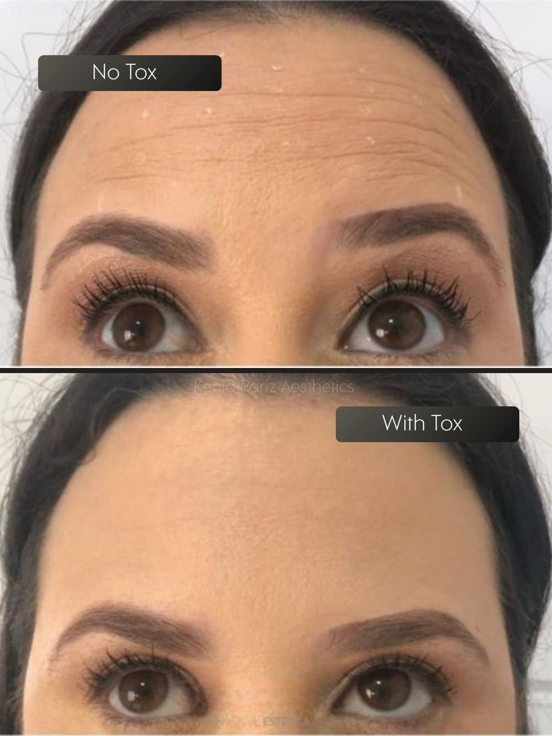 Tox before and after