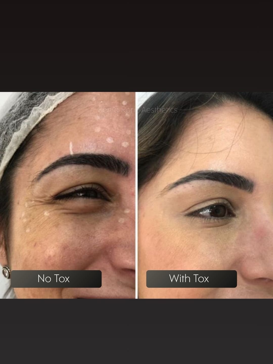 Tox before and after