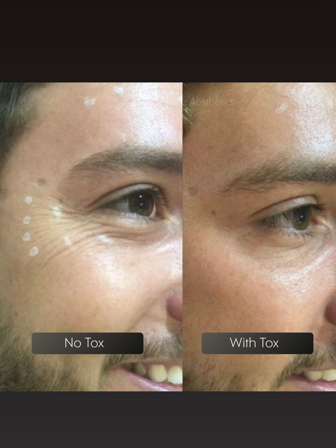 Tox before and after