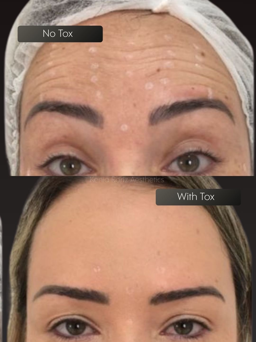 Tox before and after