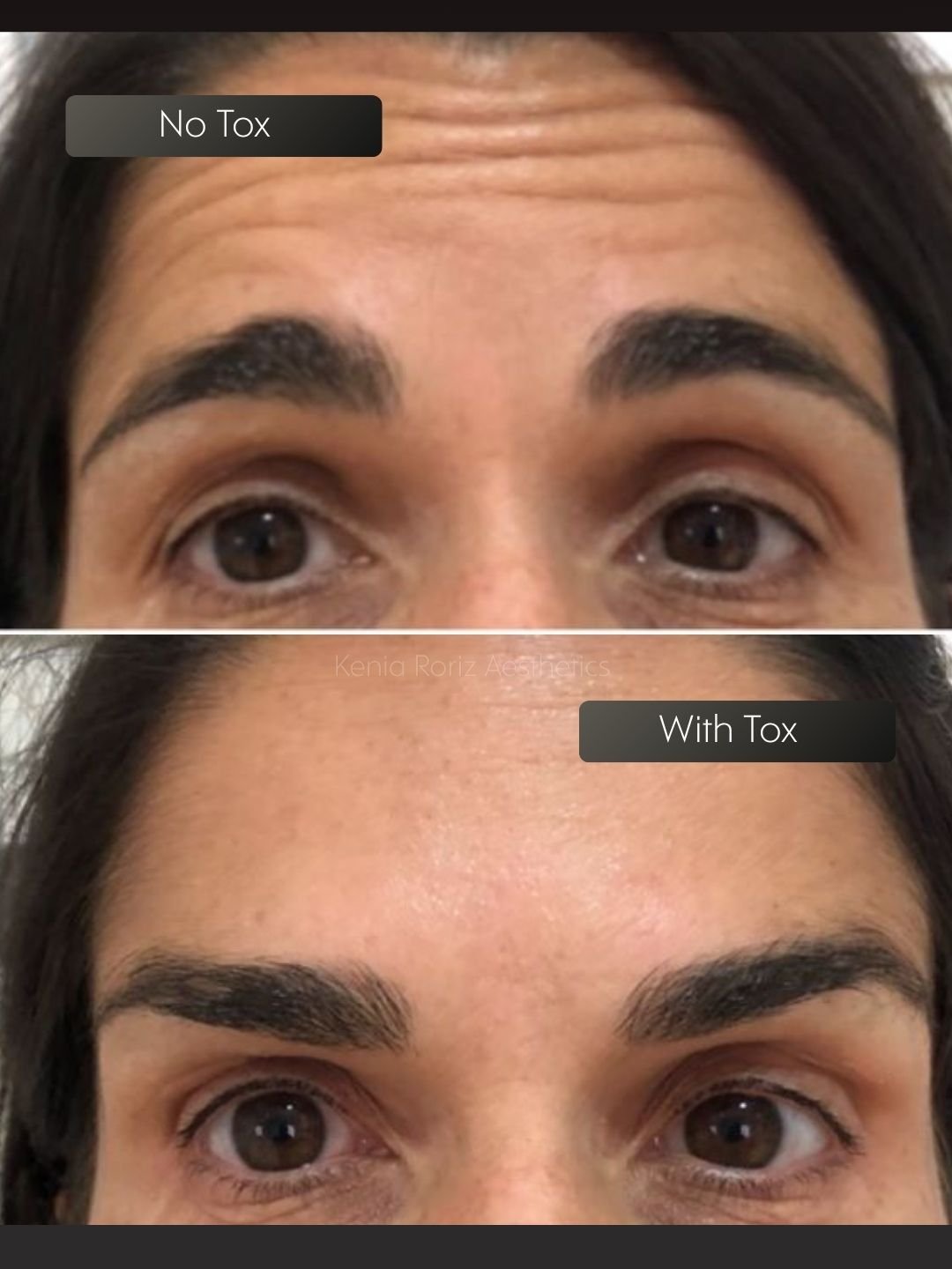 Tox before and after