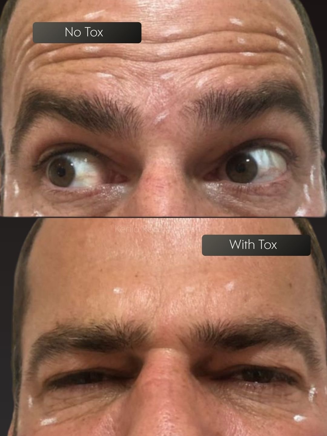 Tox before and after