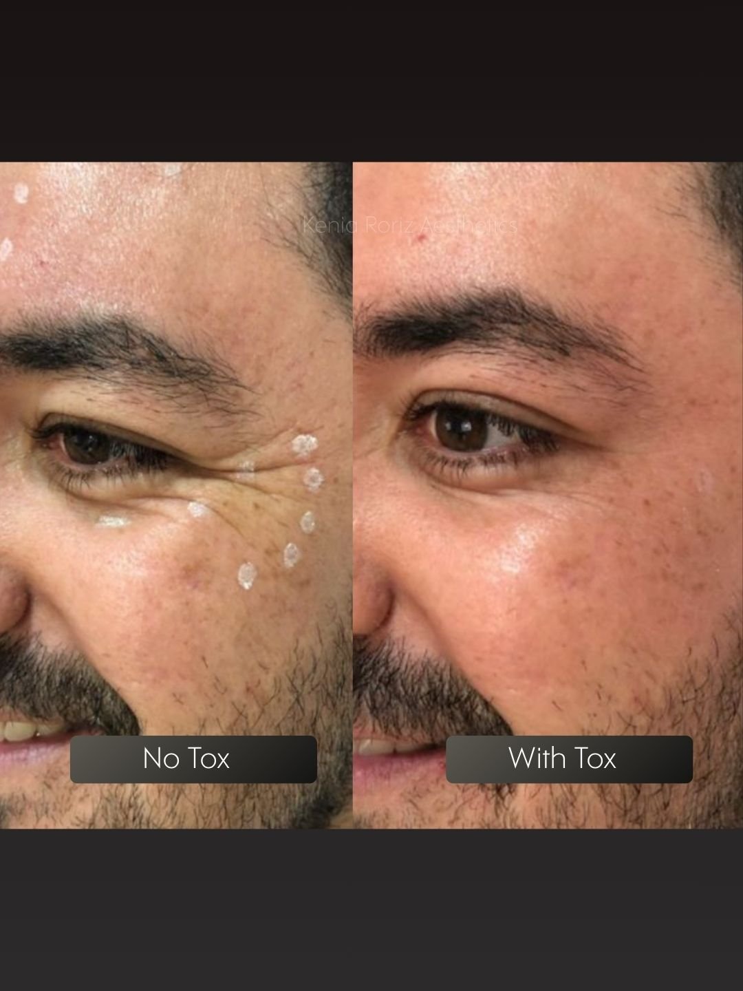 Tox before and after