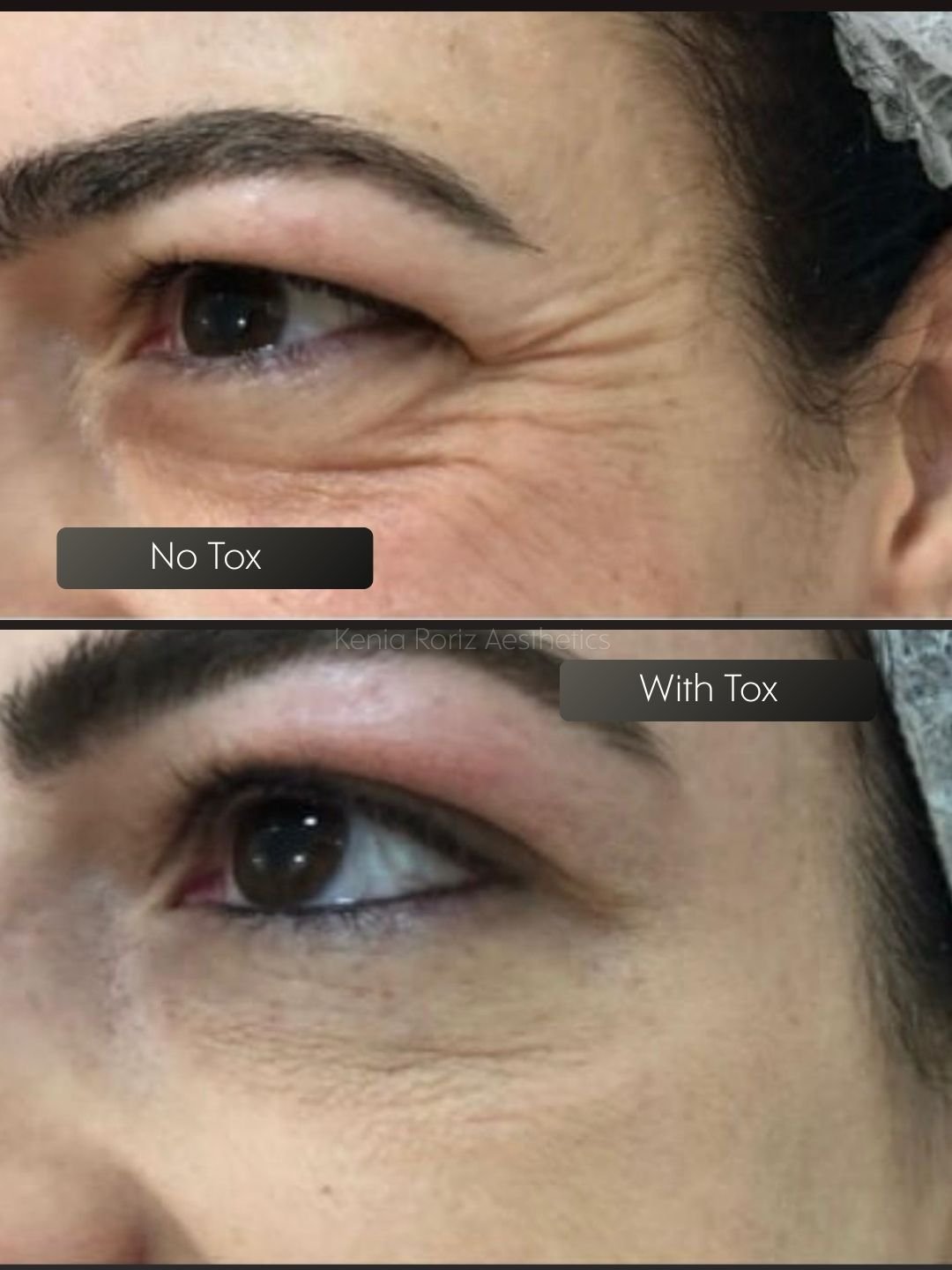 Tox before and after