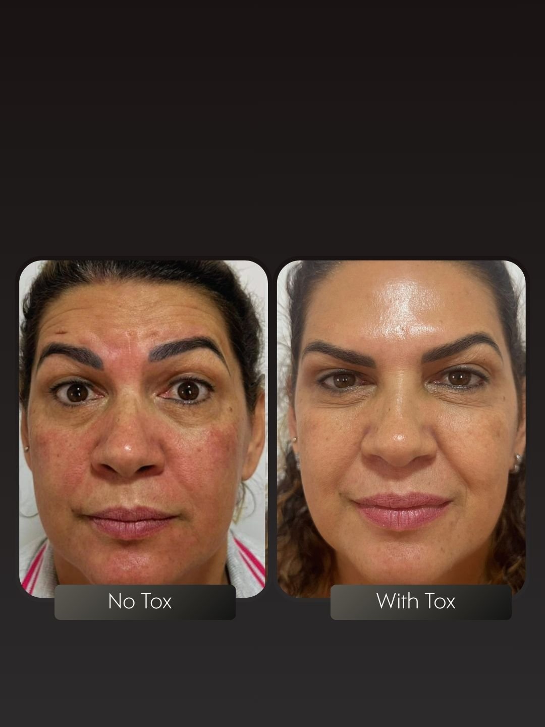 Tox before and after