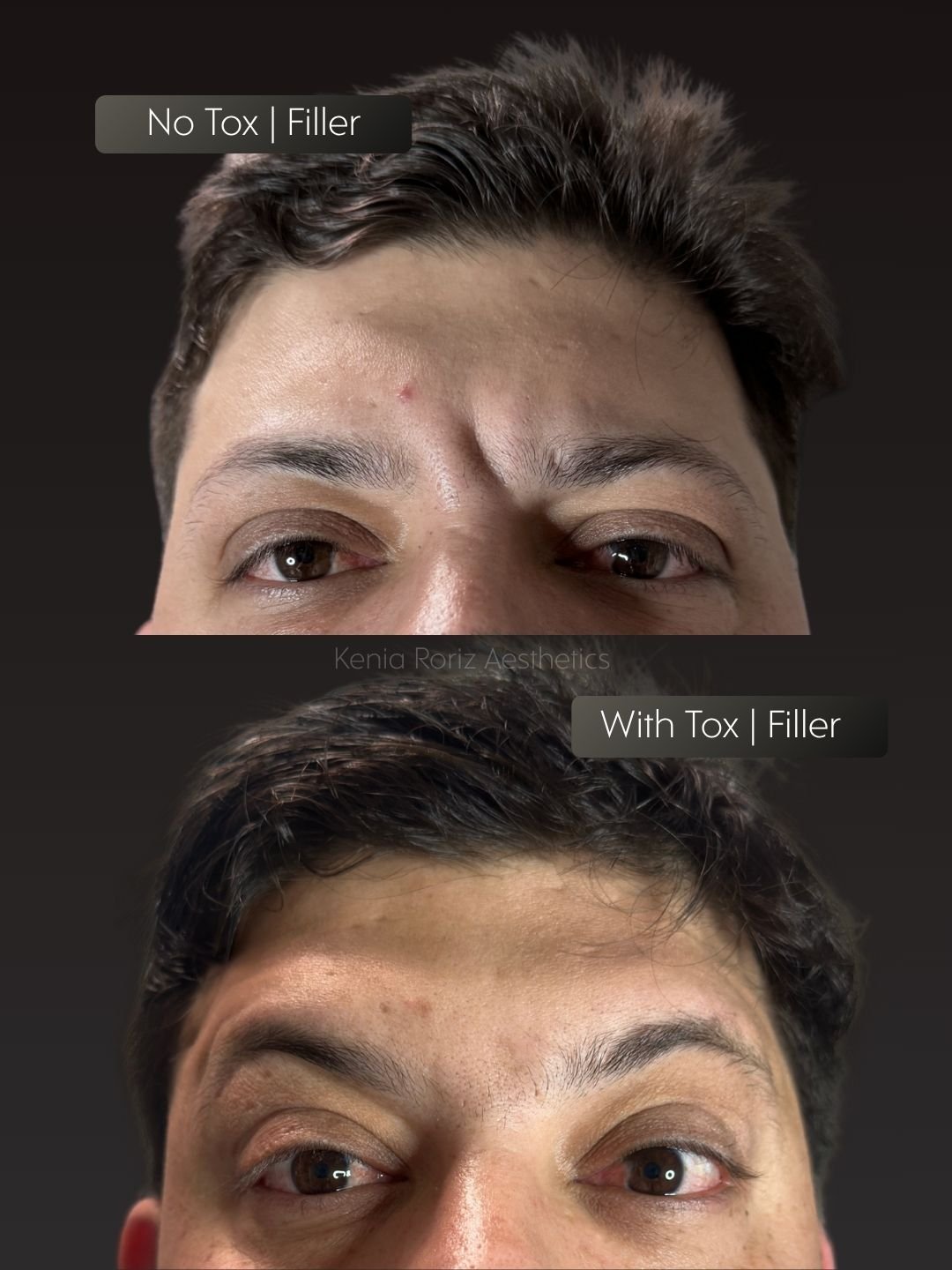 Tox before and after