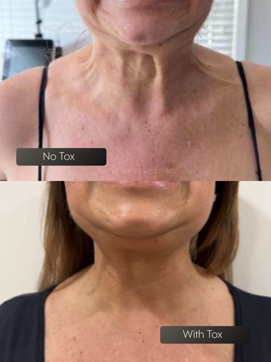 Tox before and after