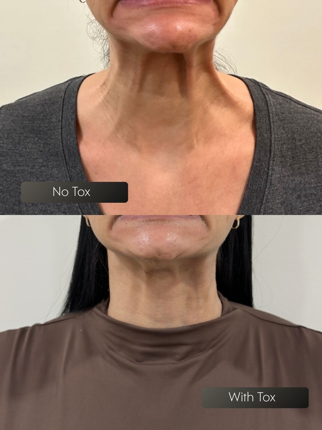 Tox before and after
